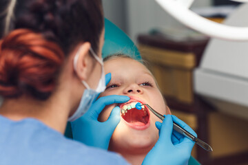 Unveiling the Power of Fluoride: A Shield Against Tooth Decay